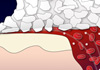 thumb1